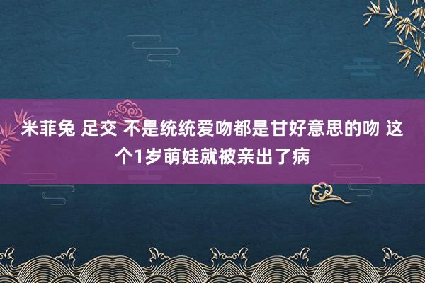 米菲兔 足交 不是统统爱吻都是甘好意思的吻 这个1岁萌娃就被亲出了病